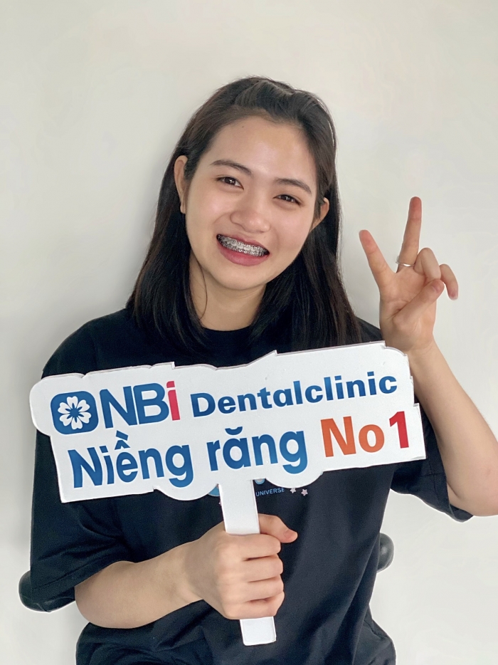 Niềng răng tại Ninh Bình- Nha khoa NBI